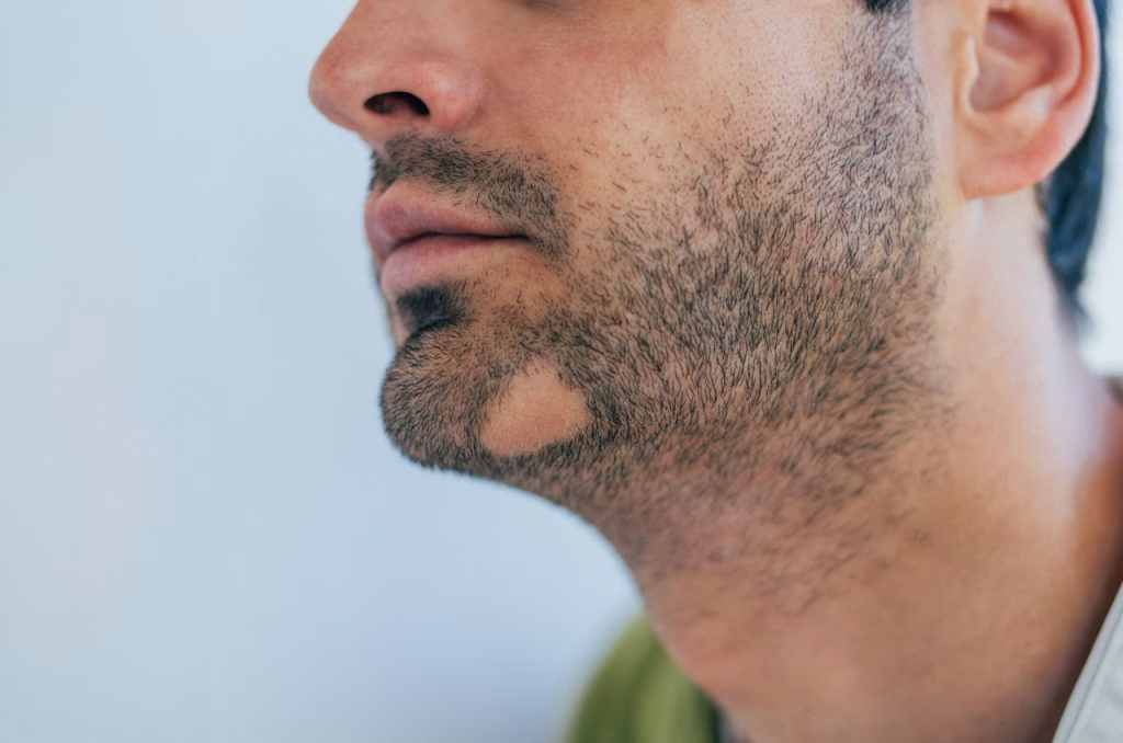 Où faire repousser sa barbe à Châteaubriant ?
